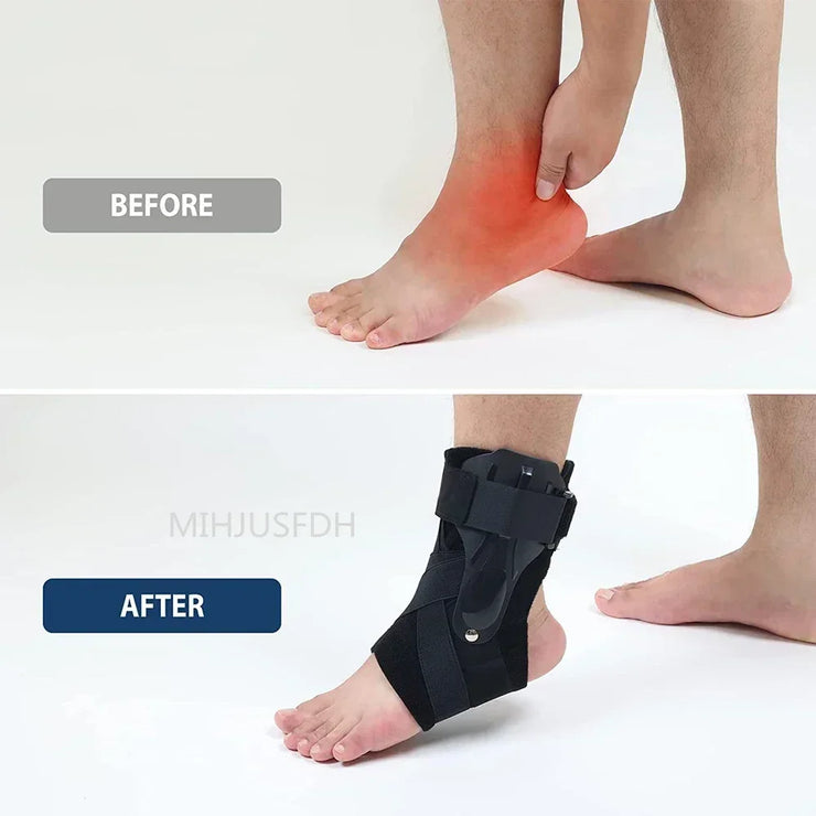 Ankle brace for sprained ankle